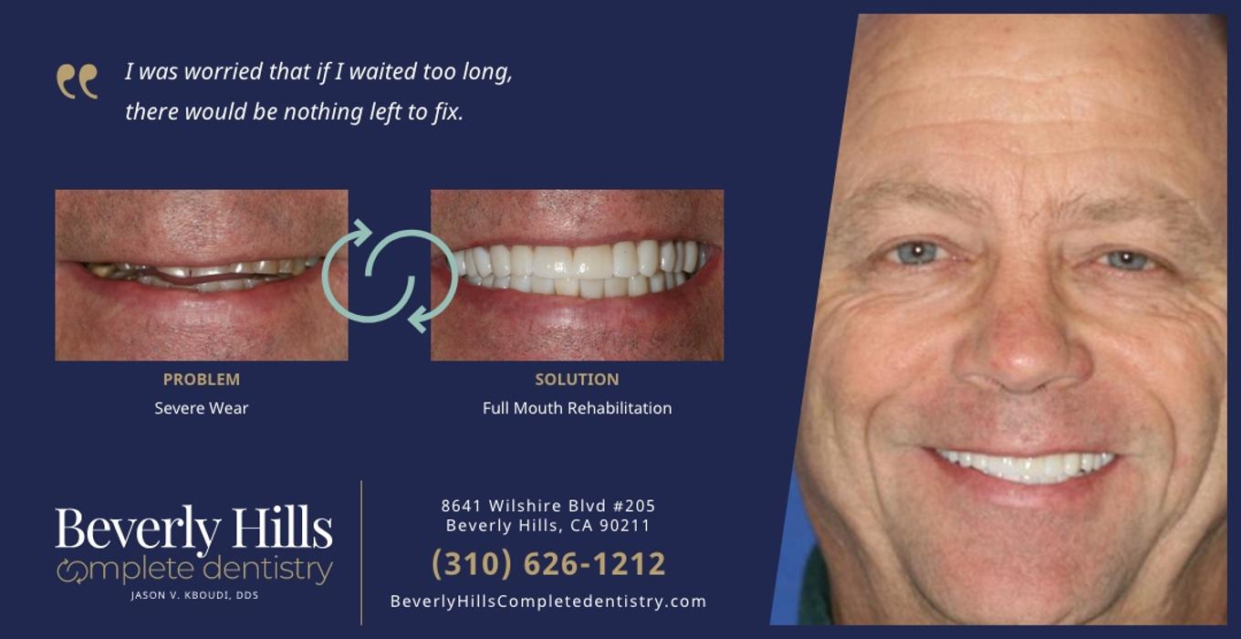 Beverly Hills Complete Dentistry Image