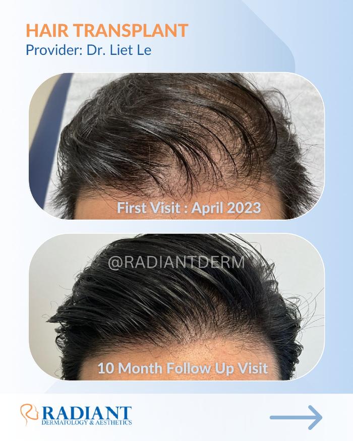 Radiant Dermatology & Aesthetics - Spring - Spring, TX