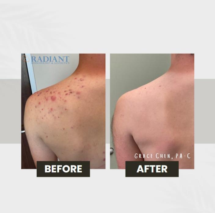 Radiant Dermatology & Aesthetics - Spring - Spring, TX