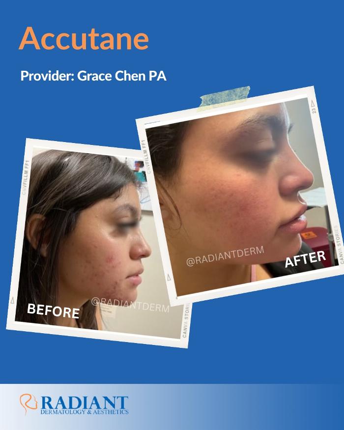 Radiant Dermatology & Aesthetics - Spring - Spring, TX