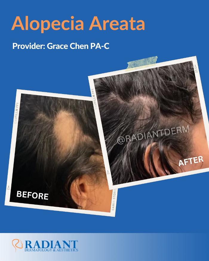 Radiant Dermatology & Aesthetics - Spring - Spring, TX