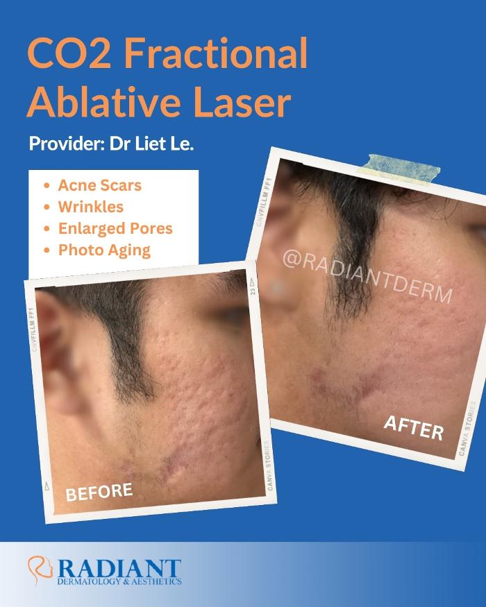 Radiant Dermatology & Aesthetics - Spring - Spring, TX
