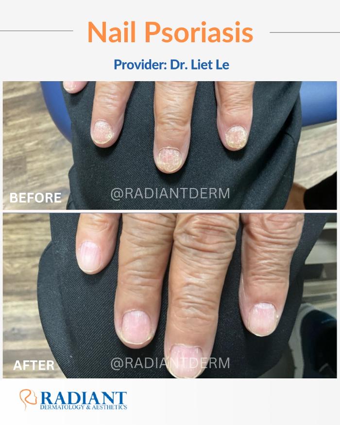Radiant Dermatology & Aesthetics - Spring - Spring, TX