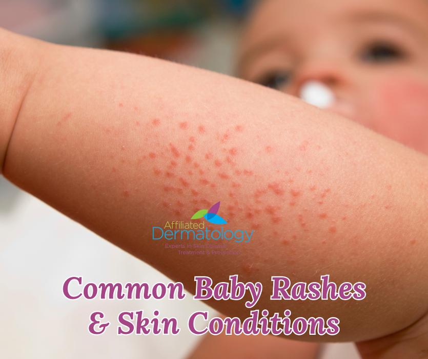 Affiliated Dermatology Deer Valley Image