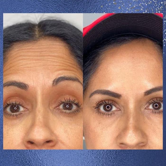 Blue Skin Laser Spa - Bronx, NY