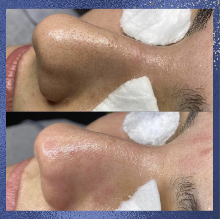 Blue Skin Laser Spa - Bronx, NY