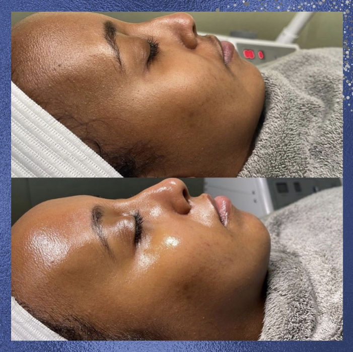 Blue Skin Laser Spa - Bronx, NY