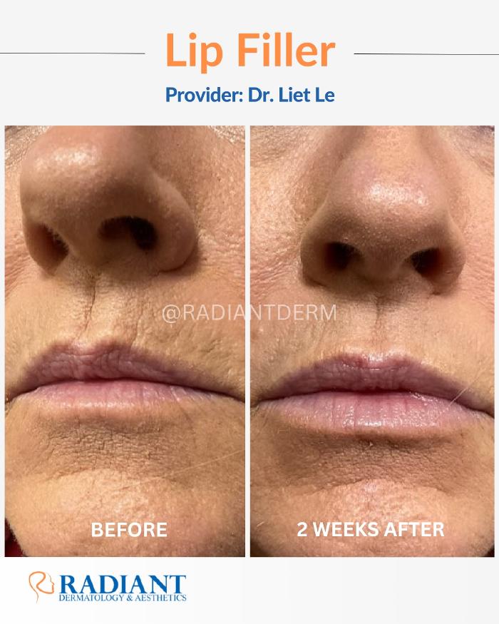 Radiant Dermatology & Aesthetics - Kingwood Image