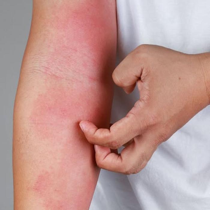 Radiant Dermatology & Aesthetics - Kingwood Image