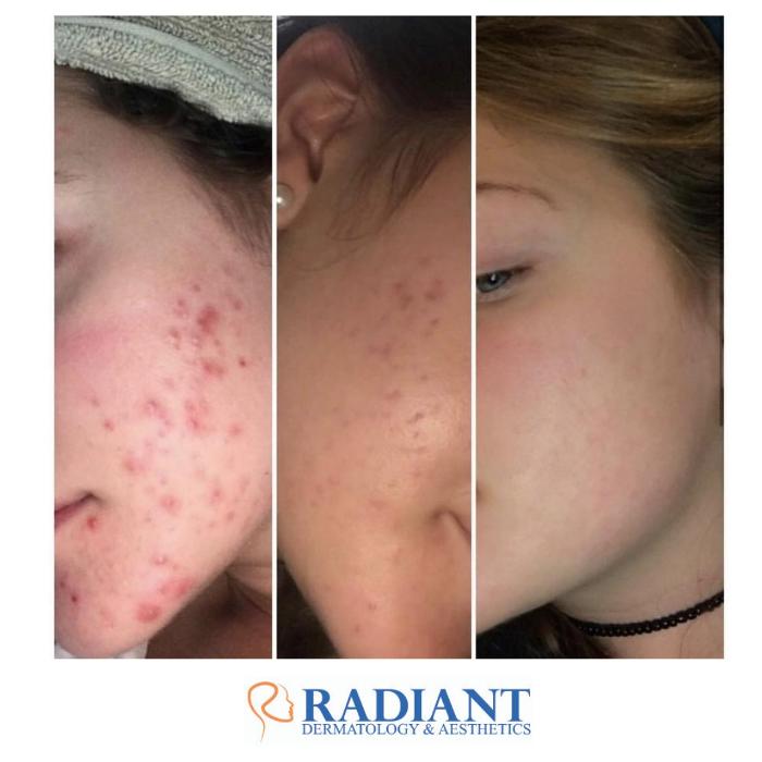 Radiant Dermatology & Aesthetics - Fall Creek - Humble, TX