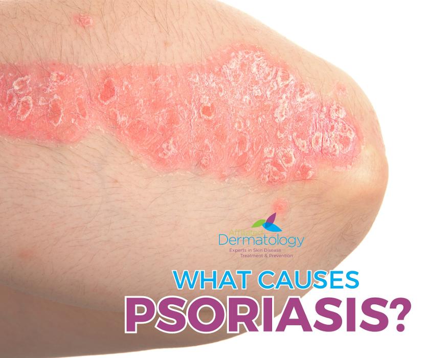 Affiliated Dermatology Anthem Image