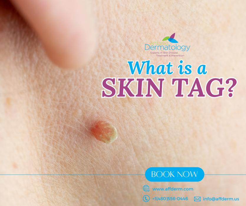 Affiliated Dermatology Anthem Image