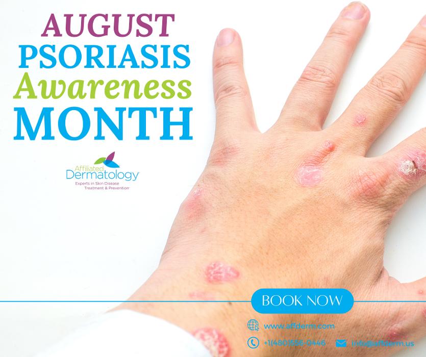 Affiliated Dermatology Anthem Image