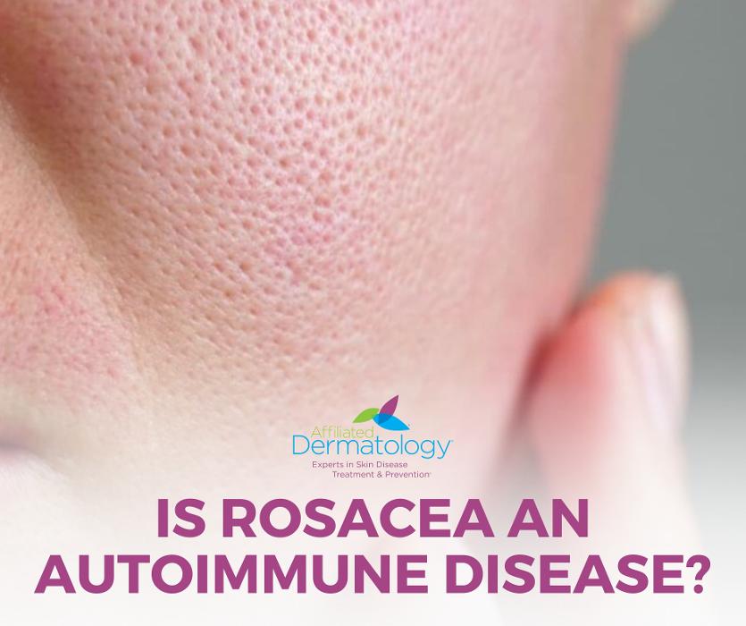 Affiliated Dermatology Anthem Image