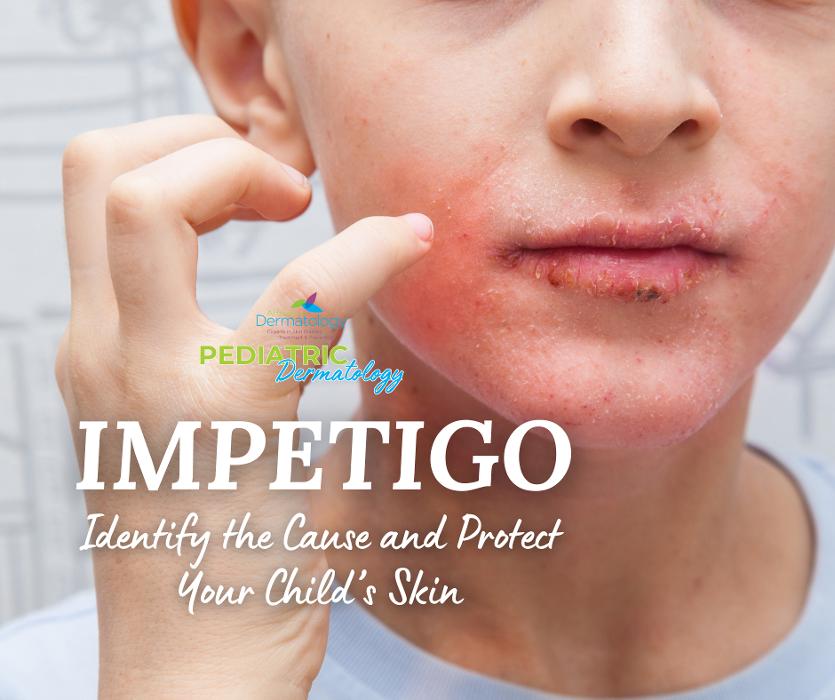 Affiliated Dermatology Anthem Image