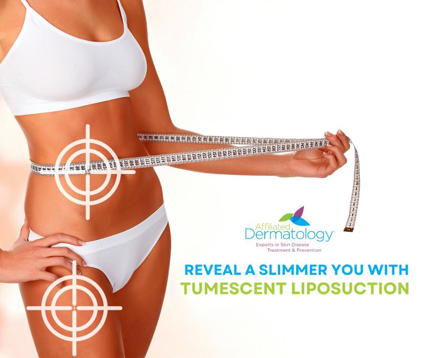 Affiliated Dermatology Anthem Image