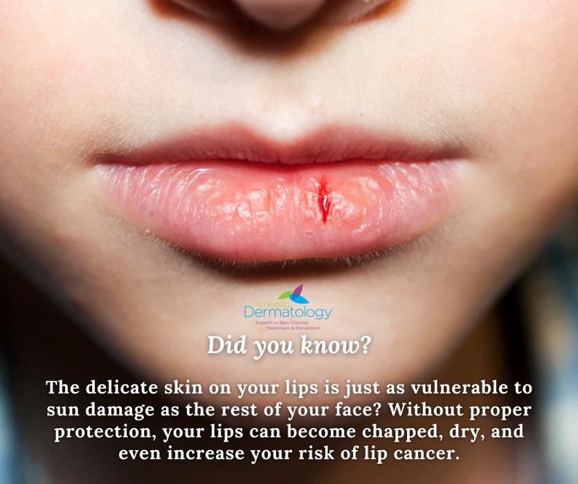 Affiliated Dermatology Anthem Image