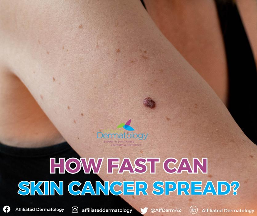 Affiliated Dermatology Anthem Image