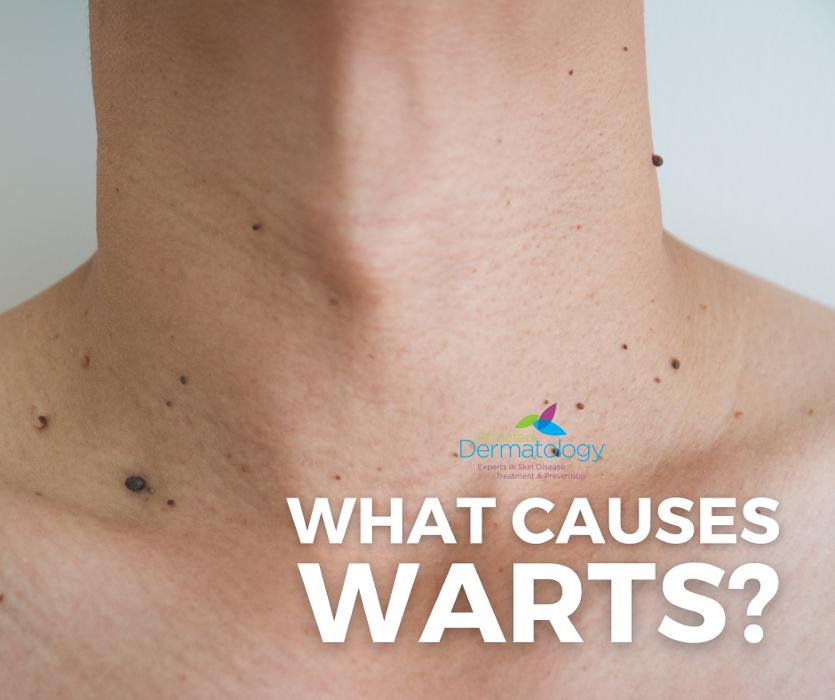 Affiliated Dermatology Anthem Image