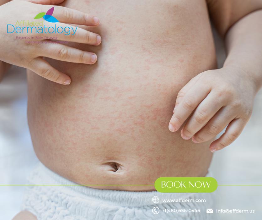 Affiliated Dermatology Anthem Image