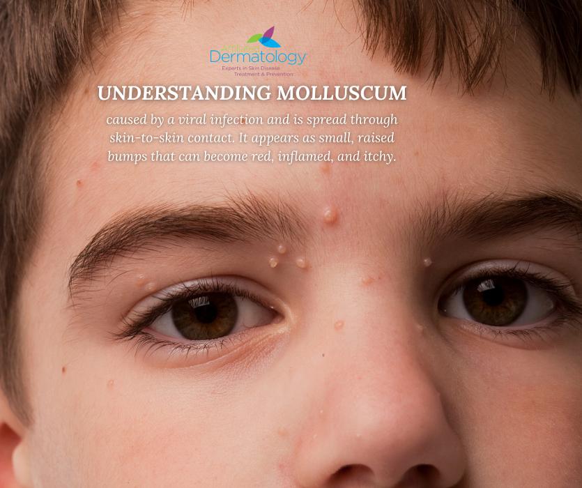 Affiliated Dermatology Anthem Image