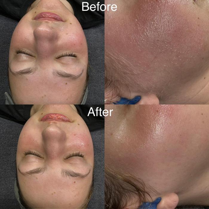 Royal Glow Beauty and Esthetics Spa - Youngstown, OH