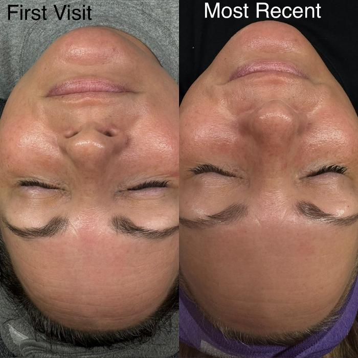 Royal Glow Beauty and Esthetics Spa - Youngstown, OH