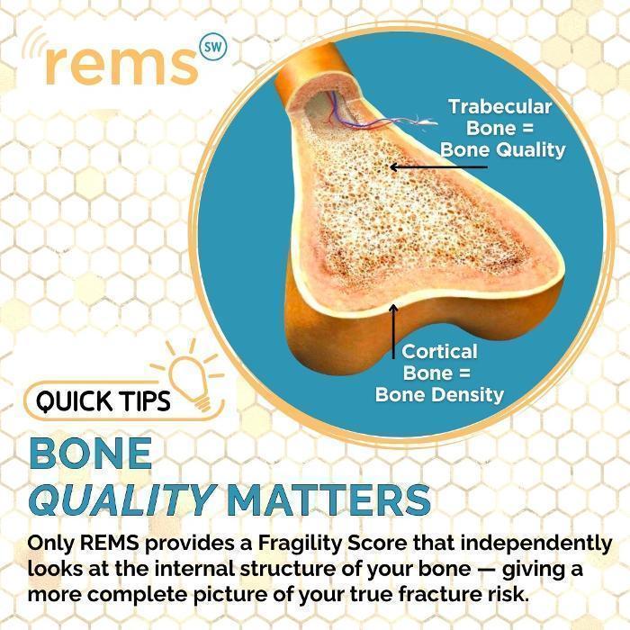 An educational graphic that explains the difference between bone density and bone quality.