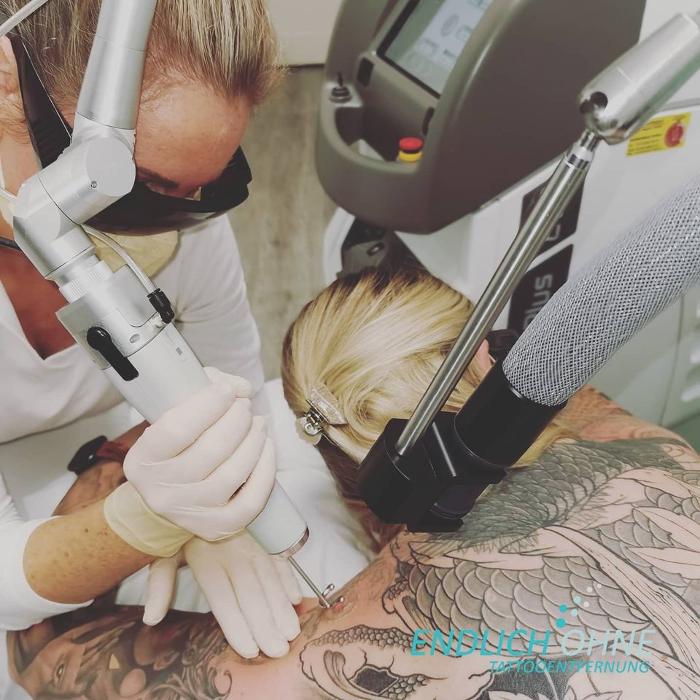 ENDLICH OHNE Tattooentfernung Filiale Kiel, Kehdenstraße in Kiel