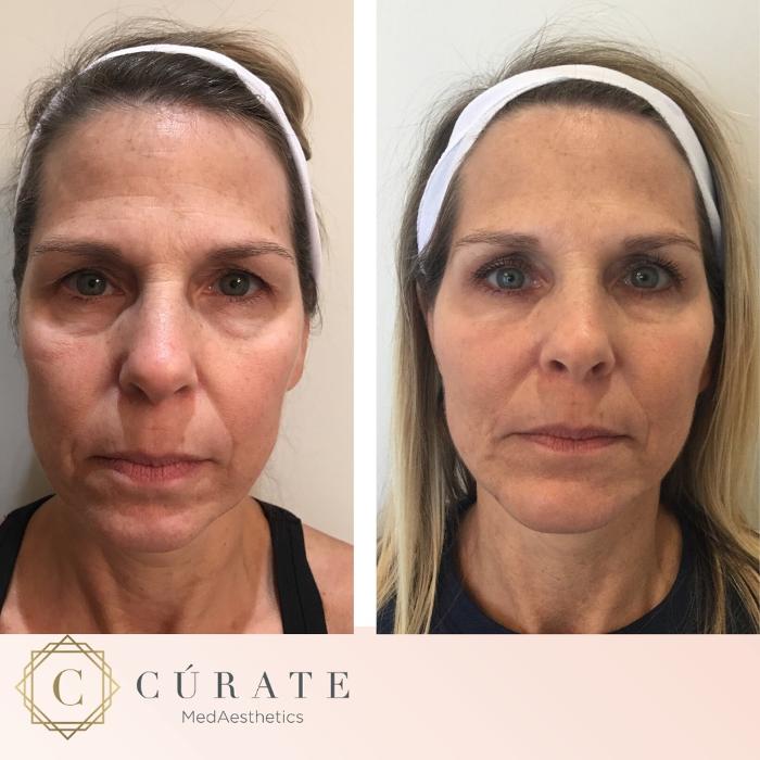 Curate MedAesthetics - Ooltewah, TN