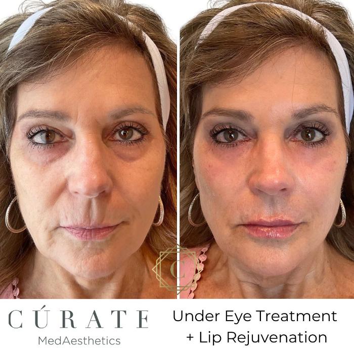 Curate MedAesthetics - Ooltewah, TN