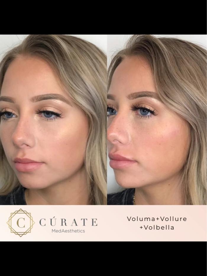 Curate MedAesthetics - Ooltewah, TN