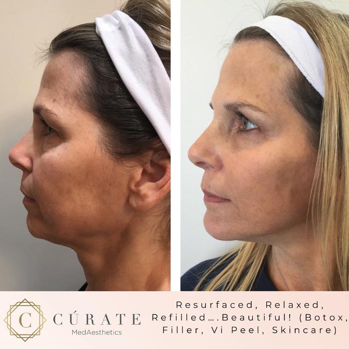 Curate MedAesthetics - Ooltewah, TN