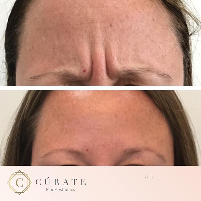 Curate MedAesthetics - Ooltewah, TN