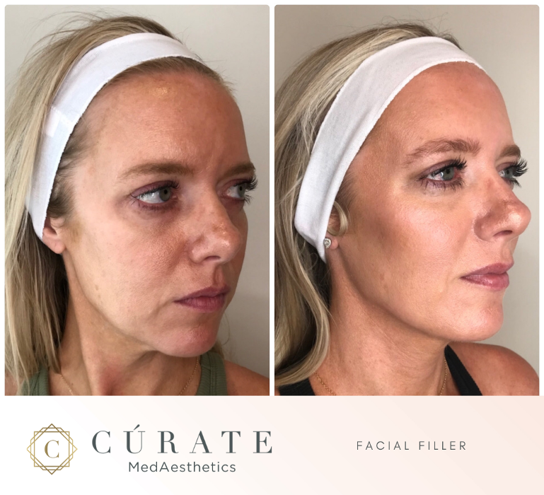Curate MedAesthetics - Ooltewah, TN