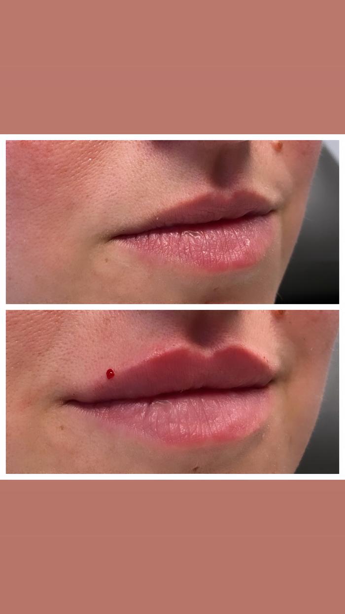 Blush Med Spa - Enfield, CT