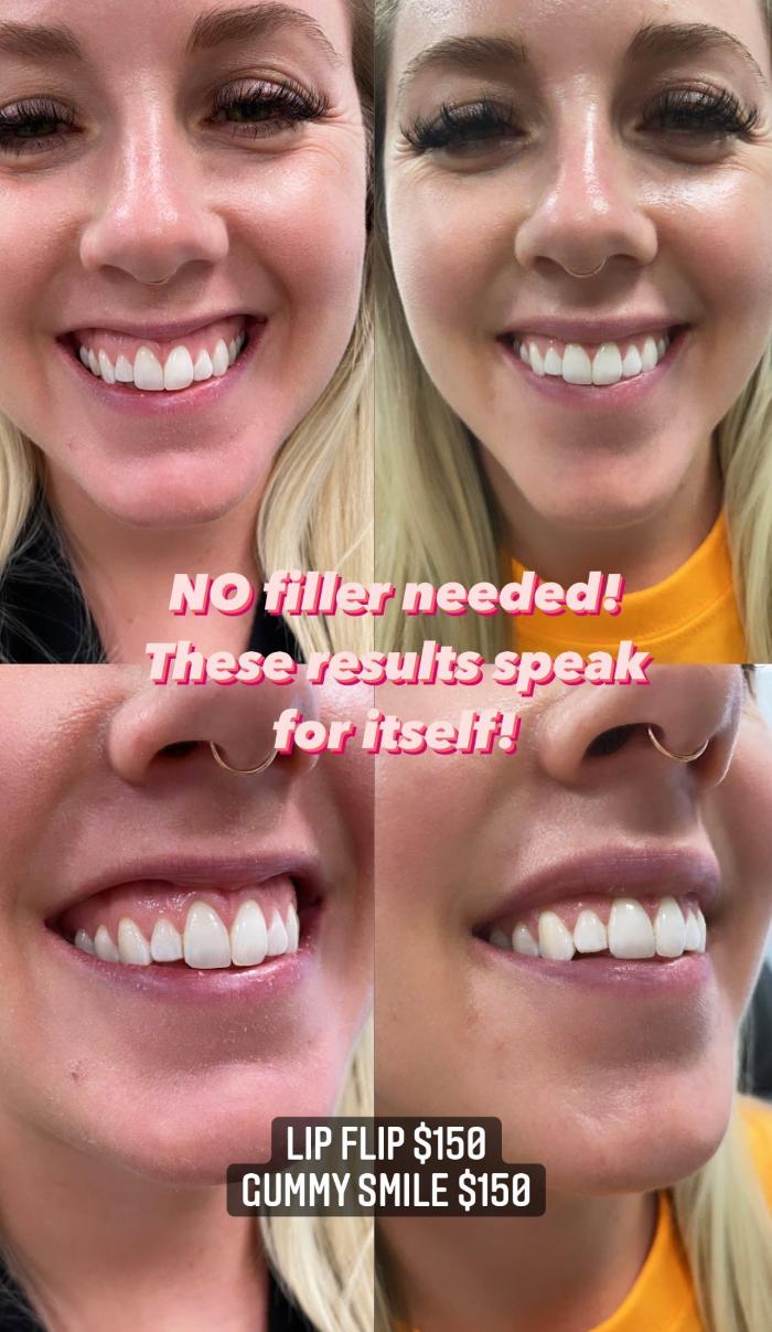 Blush Med Spa - Enfield, CT