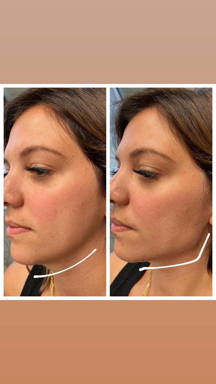 Blush Med Spa - Enfield, CT