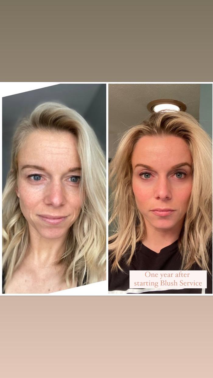 Blush Med Spa - Enfield, CT