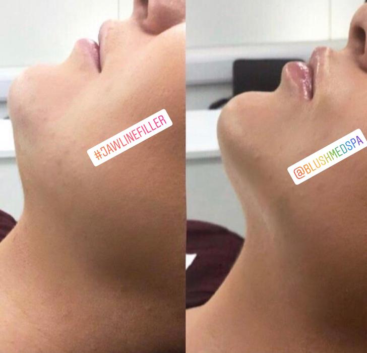 Blush Med Spa - Enfield, CT