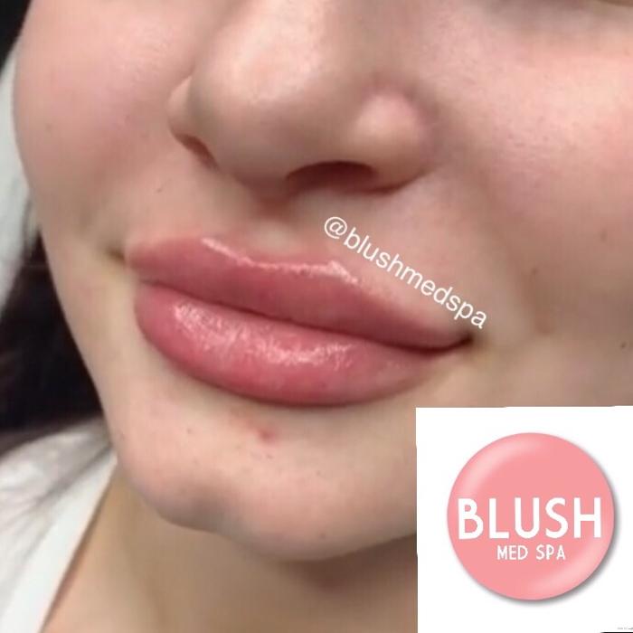 Blush Med Spa - Enfield, CT