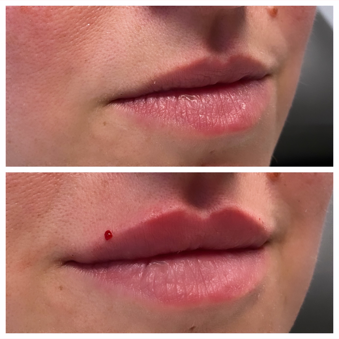 Blush Med Spa - Enfield, CT