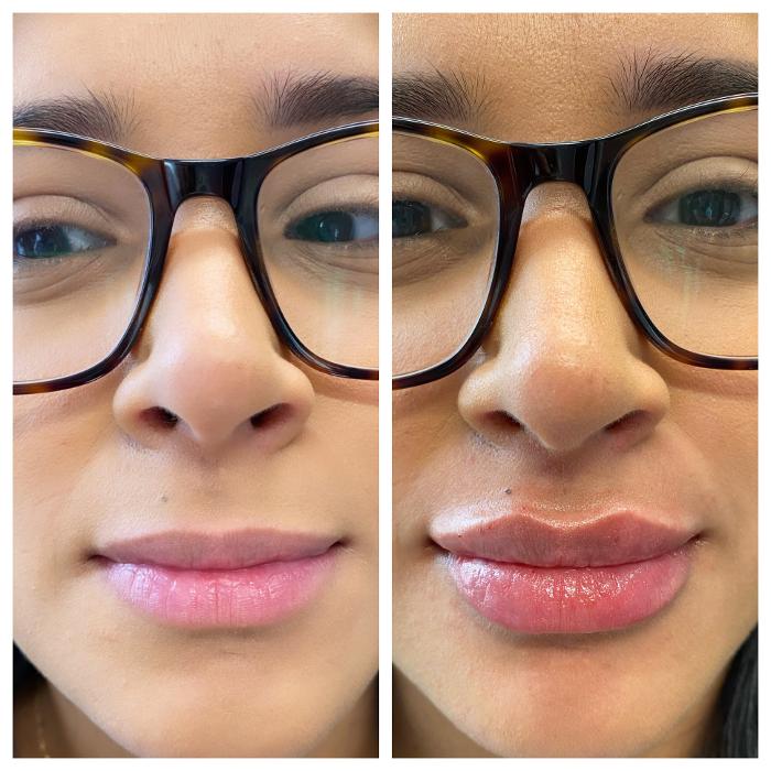 Blush Med Spa - Enfield, CT