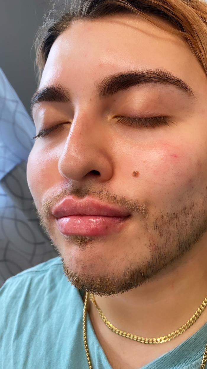 Blush Med Spa - Enfield, CT