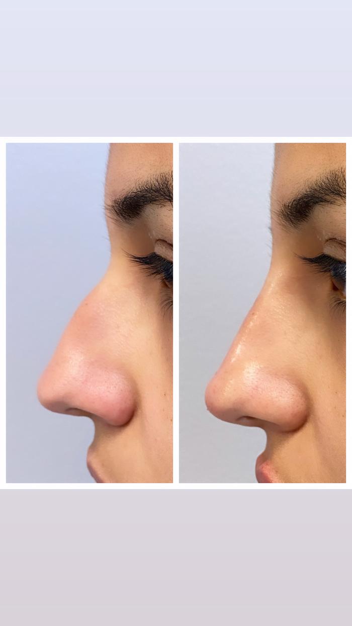 Blush Med Spa - Enfield, CT