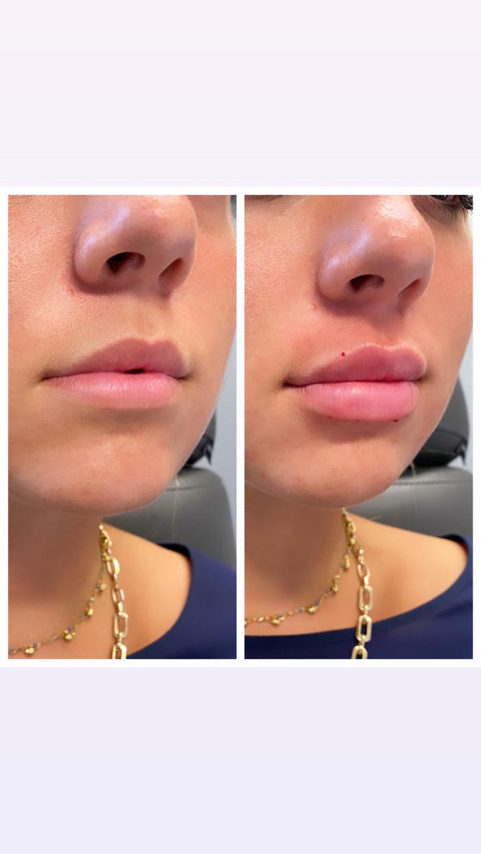 Blush Med Spa - Enfield, CT