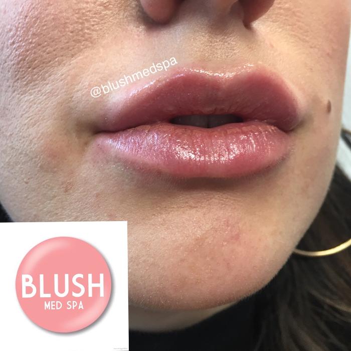 Blush Med Spa - Enfield, CT
