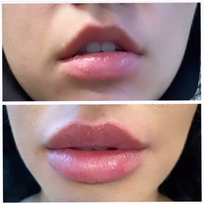 Blush Med Spa - Enfield, CT