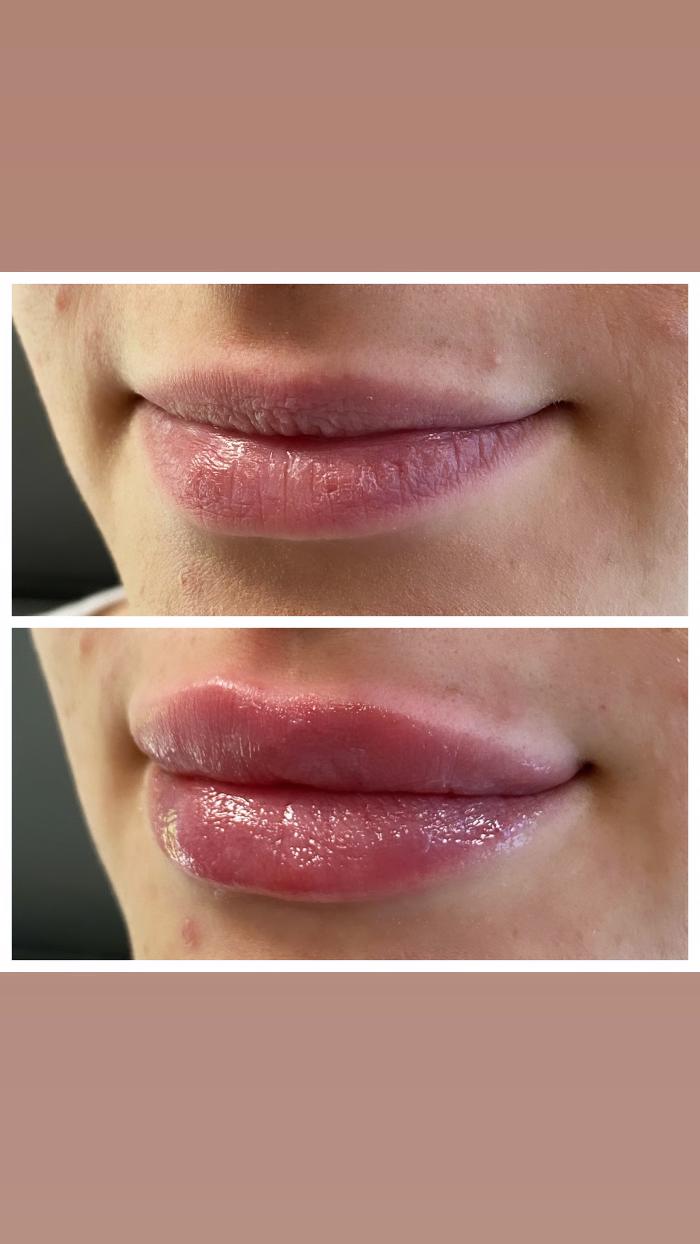 Blush Med Spa - Enfield, CT