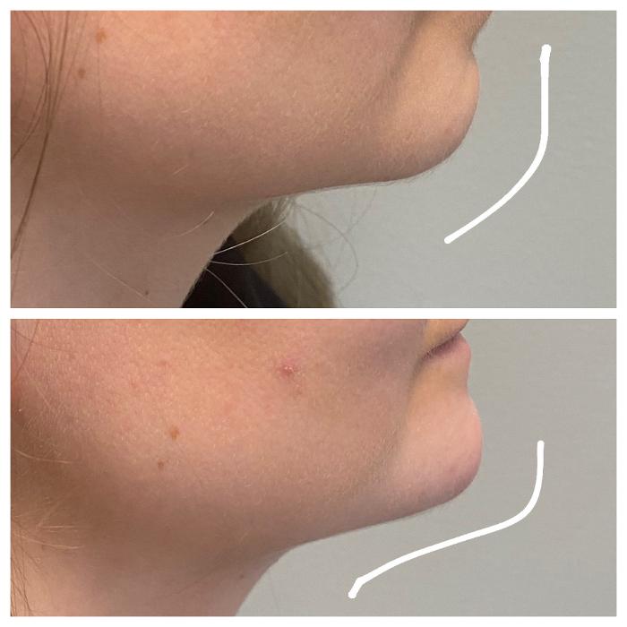 Blush Med Spa - Enfield, CT